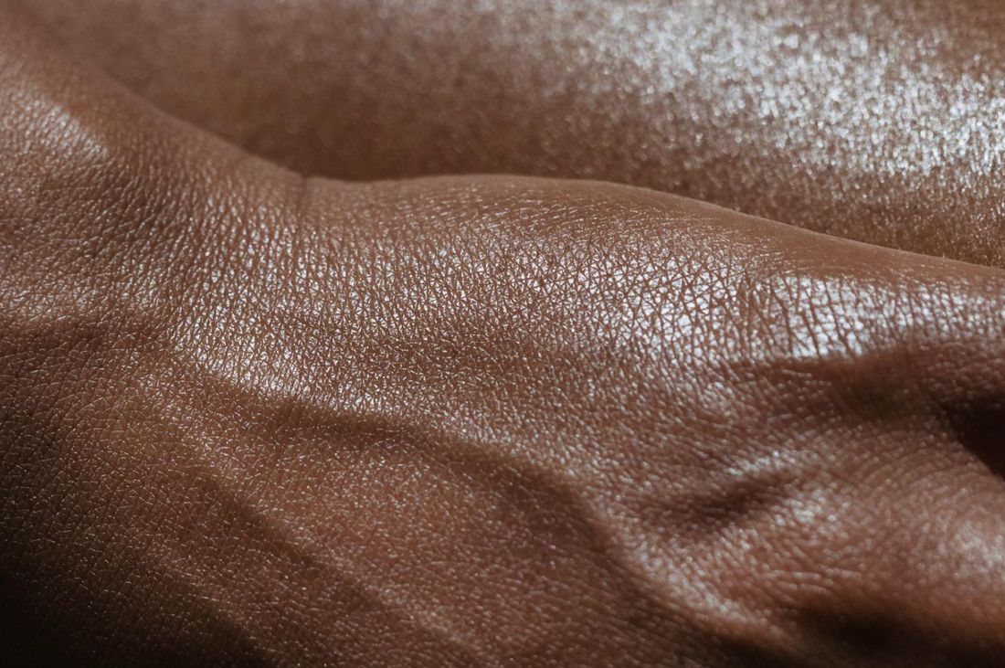What to Do When Your Skin Needs Help
